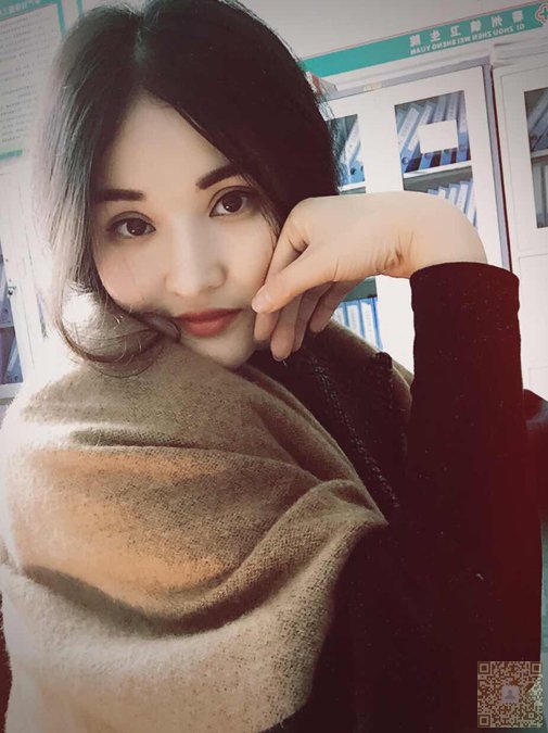 超声波双眼皮值得你去选择843 超声波双眼皮值得你去选择843