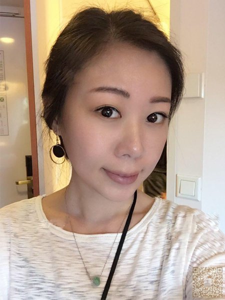 超声波祛眼袋不留任何痕迹968