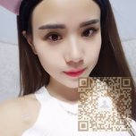 超声波双眼皮后变得好漂亮052 超声波双眼皮后变得好漂亮052