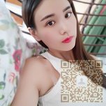 超声波双眼皮后变得好漂亮052 超声波双眼皮后变得好漂亮052