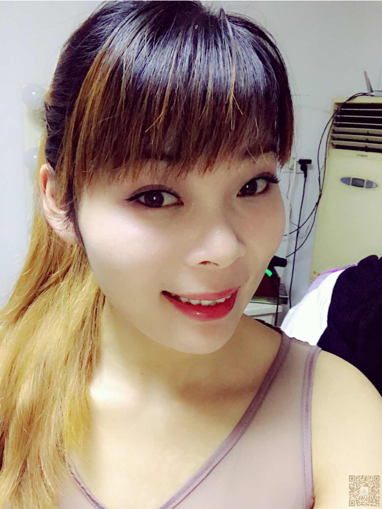 wǒ去超雅做超 声 波双眼 皮得经历分享给你们 wǒ去超雅做超 声 波双眼 皮得经历分享给你们