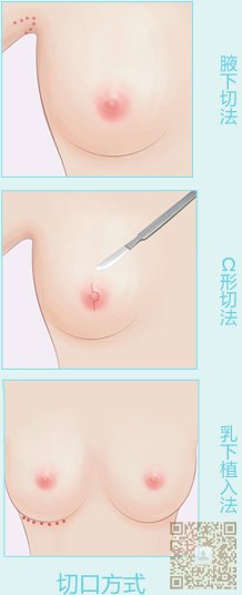 超声波丰胸让你拥有迷人好身材874 超声波丰胸让你拥有迷人好身材874