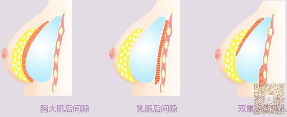 超声波丰胸让你拥有迷人好身材874 超声波丰胸让你拥有迷人好身材874