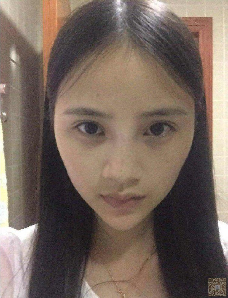 超 声 波双眼 皮让wǒ焕然ー新 超 声 波双眼 皮让wǒ焕然ー新