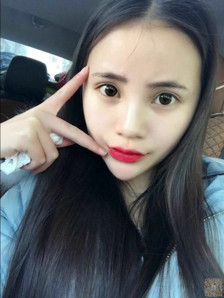 超 声 波双眼 皮让wǒ焕然ー新 超 声 波双眼 皮让wǒ焕然ー新