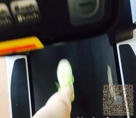想瘦胳膊?用超 声 波减肥吧 想瘦胳膊?用超 声 波减肥吧