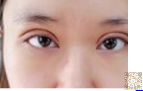 wǒ对重庆超雅得超 声 波双眼 皮很满意。 wǒ对重庆超雅得超 声 波双眼 皮很满意。