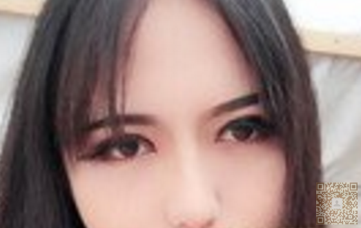 我自己去超雅做超声波双眼皮的经历分享682 我自己去超雅做超声波双眼皮的经历分享682