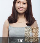 超声波丰胸让你更有女人味233 超声波丰胸让你更有女人味233
