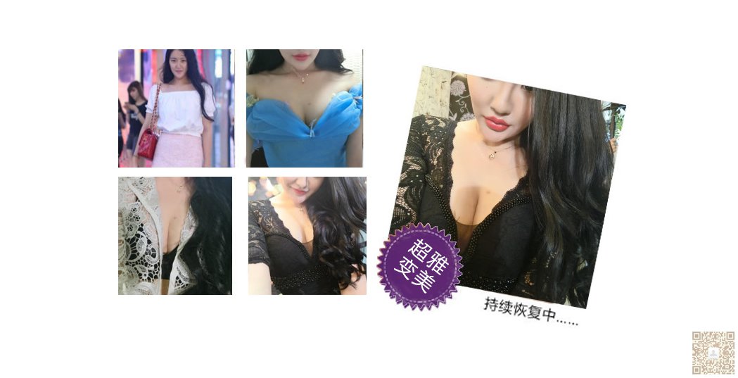 超声波丰胸让你拥有少女般的胸部176 超声波丰胸让你拥有少女般的胸部176