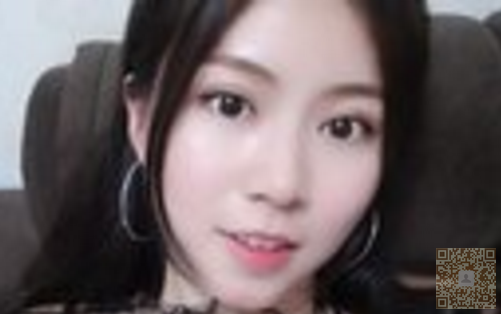 我做超声波双眼皮的亲身经历847 我做超声波双眼皮的亲身经历847