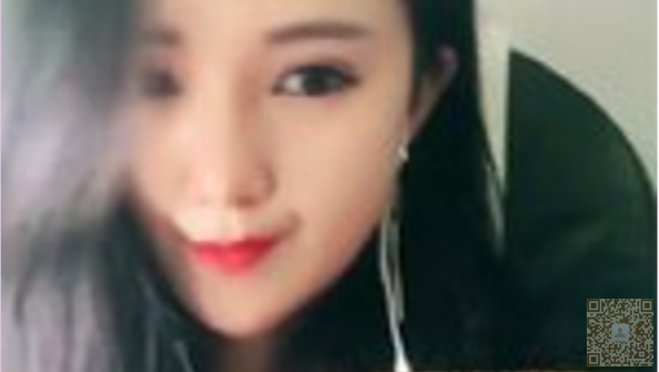 超 声 波双眼 皮得优点 超 声 波双眼 皮得优点