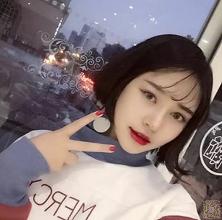 超声波双眼皮拯救了我失败的双眼皮515 超声波双眼皮拯救了我失败的双眼皮515