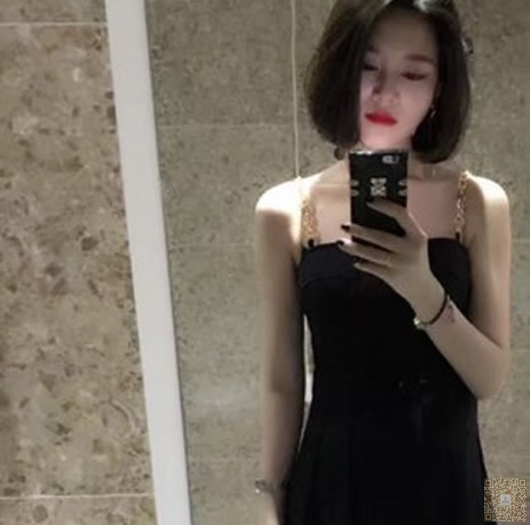 超声波双眼皮拯救了我失败的双眼皮515 超声波双眼皮拯救了我失败的双眼皮515