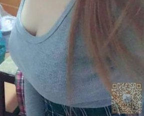 选择自体脂肪填充真的没错，我做的超声波自体脂肪丰胸很棒407