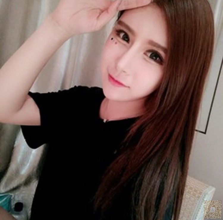 超声波双眼皮解除单眼皮的苦恼930 超声波双眼皮解除单眼皮的苦恼930