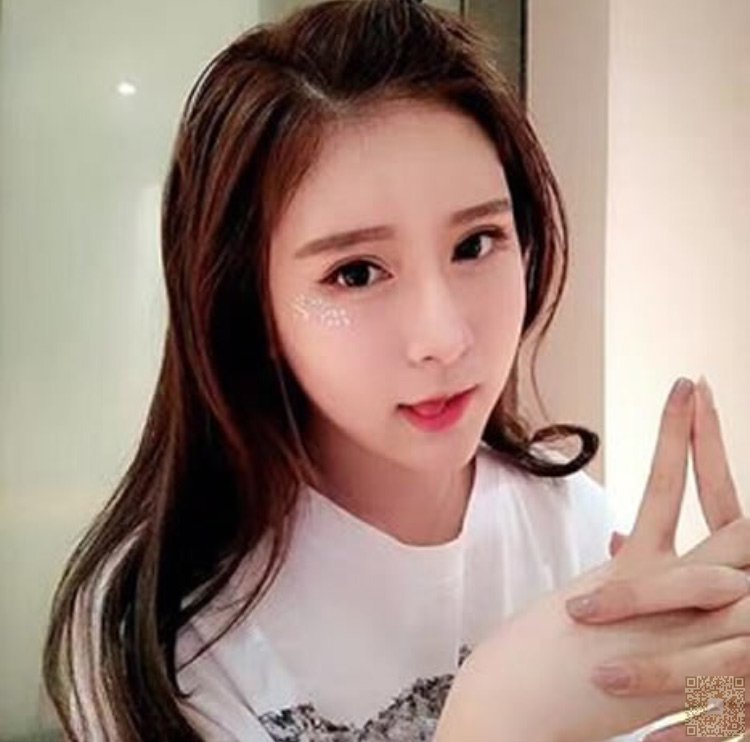 我老公陪我去超雅做超声波双眼皮424 我老公陪我去超雅做超声波双眼皮424
