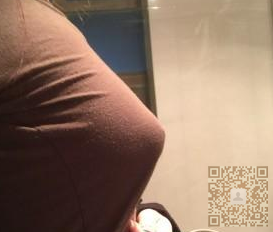 好看的胸全靠超声波自体脂肪丰胸171 好看的胸全靠超声波自体脂肪丰胸171