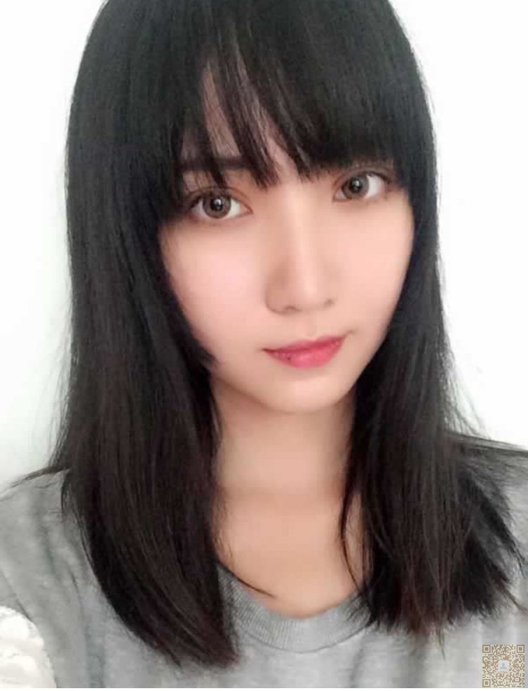 超声波双眼皮原来可以这么自然656 超声波双眼皮原来可以这么自然656