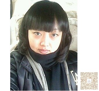超声法减肥让我做个美丽新娘434 超声法减肥让我做个美丽新娘434