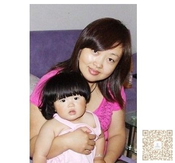 超声法减肥让我做个美丽新娘434 超声法减肥让我做个美丽新娘434
