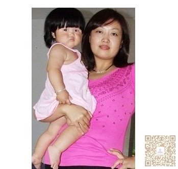 超声法减肥让我做个美丽新娘434 超声法减肥让我做个美丽新娘434
