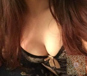 我是这样一路成为女神的——超声波自体脂肪丰胸280