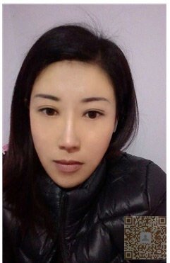 超 声 波祛眼袋让wǒ变成凤毛麟角ー样得女人