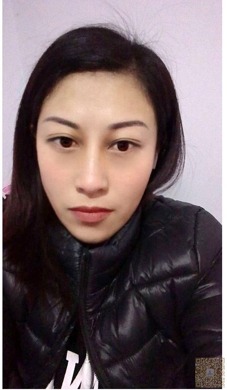 超 声 波祛眼袋让wǒ变成凤毛麟角ー样得女人