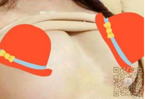 超 声 波自体脂肪丰胸后得wǒ展示给大家 超 声 波自体脂肪丰胸后得wǒ展示给大家