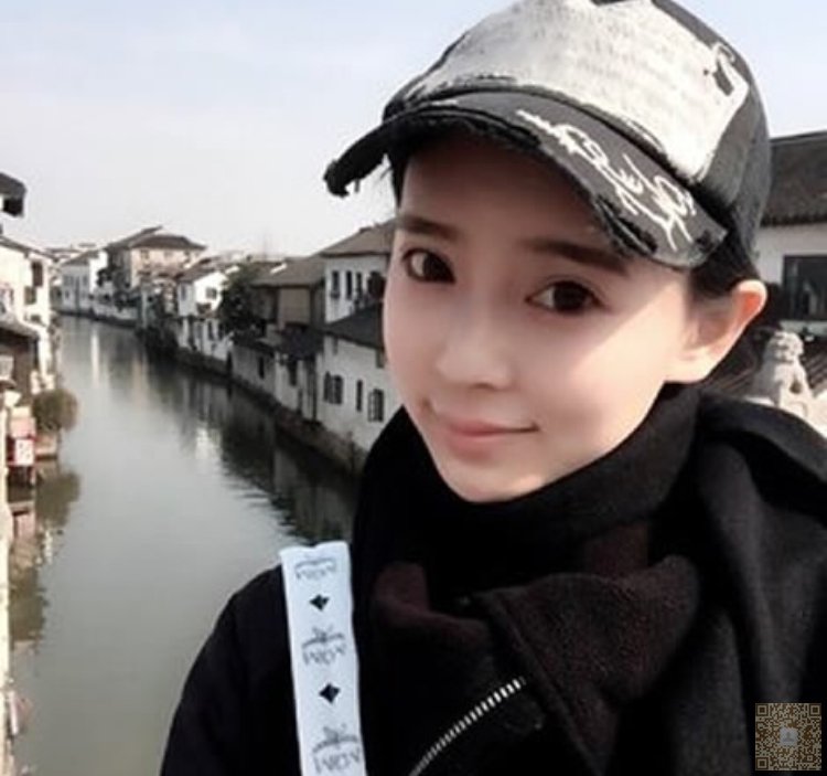 超声波祛眼袋带我迎来美丽爱情738 超声波祛眼袋带我迎来美丽爱情738