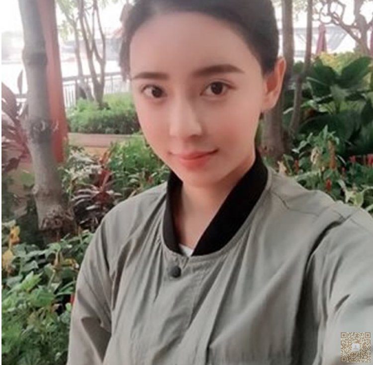 超声波祛眼袋带我迎来美丽爱情738 超声波祛眼袋带我迎来美丽爱情738