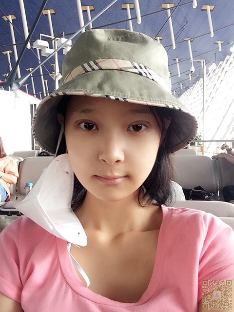 想要变成双眼皮就来到超雅做超声波双眼皮手术吧！733