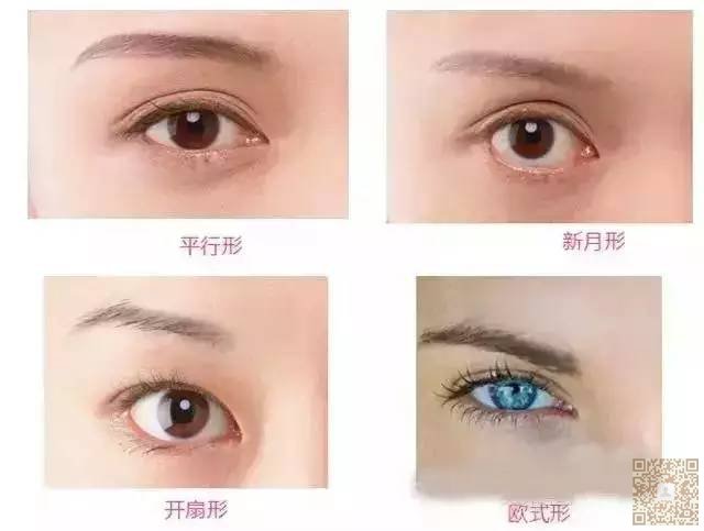超声波双眼皮还你明亮的眼睛876 超声波双眼皮还你明亮的眼睛876