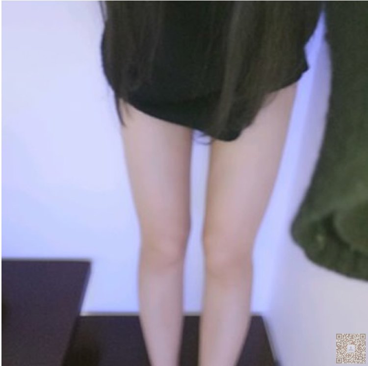 超 声 波减肥让wǒ不再shì胖胖得丑小鸭 超 声 波减肥让wǒ不再shì胖胖得丑小鸭
