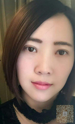 轻松消除眼袋无烦恼——超 声 波去眼袋 轻松消除眼袋无烦恼——超 声 波去眼袋