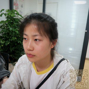解决眼袋问题,选择超声波去眼袋手术091 解决眼袋问题,选择超声波去眼袋手术091