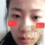 解决眼袋问题,选择超声波去眼袋手术091 解决眼袋问题,选择超声波去眼袋手术091