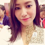 分享一个超级棒的去眼袋手术——超声波去眼袋466 分享一个超级棒的去眼袋手术——超声波去眼袋466