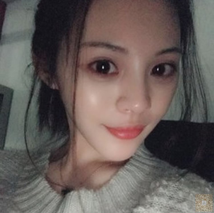 超声波祛眼袋让你体验舒适的按摩426 超声波祛眼袋让你体验舒适的按摩426