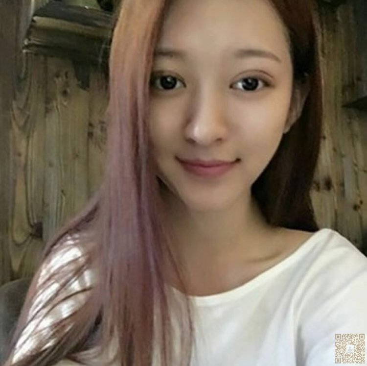 超声波双眼皮圆满我的漂亮脸蛋472 超声波双眼皮圆满我的漂亮脸蛋472