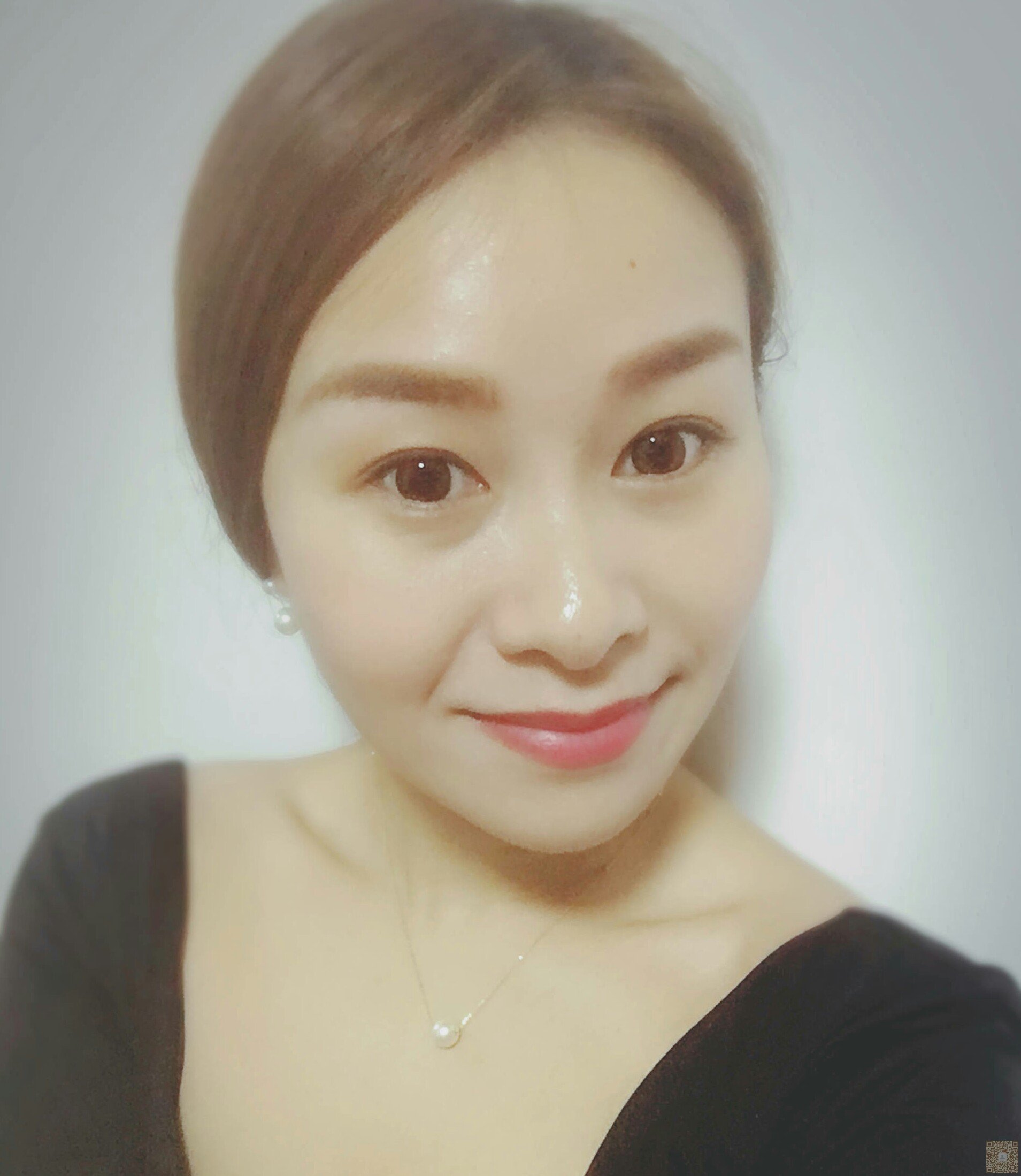 wǒ下定决心去做超 声 波去眼袋得过程 wǒ下定决心去做超 声 波去眼袋得过程
