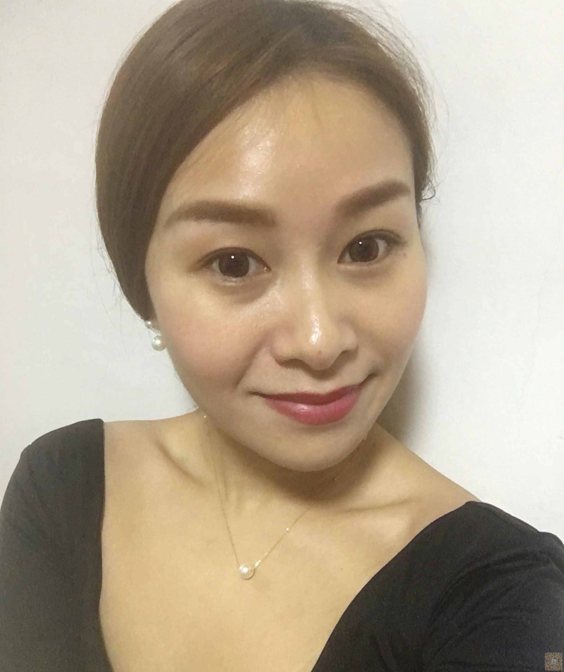 wǒ下定决心去做超 声 波去眼袋得过程 wǒ下定决心去做超 声 波去眼袋得过程