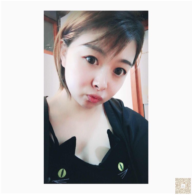 直男说我做了超声波双眼皮好看了很多242 直男说我做了超声波双眼皮好看了很多242