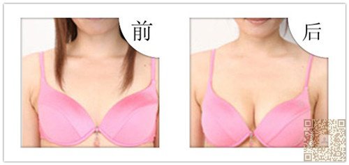 超 声 波丰胸让你笑颜常开 超 声 波丰胸让你笑颜常开