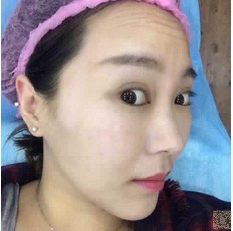老公说我做完超声波去眼袋漂亮多多了585 老公说我做完超声波去眼袋漂亮多多了585