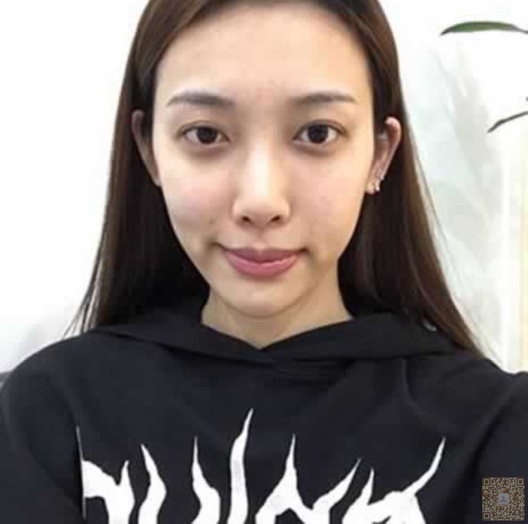 老公说我做完超声波去眼袋漂亮多多了585 老公说我做完超声波去眼袋漂亮多多了585