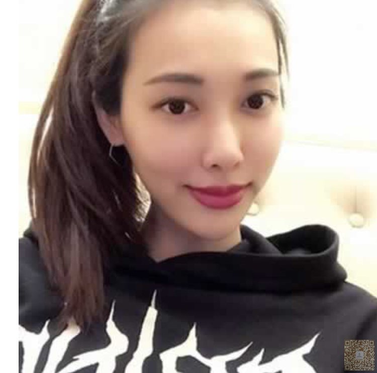 老公说我做完超声波去眼袋漂亮多多了585 老公说我做完超声波去眼袋漂亮多多了585