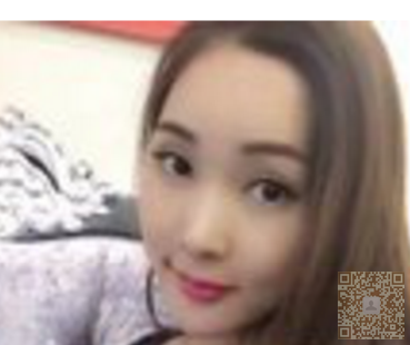 化学系得大学生去做超 声 波去眼袋得经历 化学系得大学生去做超 声 波去眼袋得经历