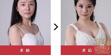 超 声 波丰胸技术瞬间让很多男生追wǒ 超 声 波丰胸技术瞬间让很多男生追wǒ